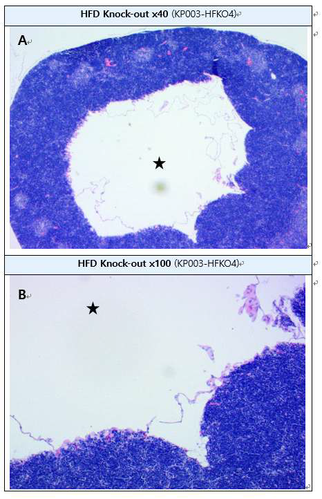 Epithelial cyst in thymus (H&E staining) A: duodenum, B : High-magnification of A