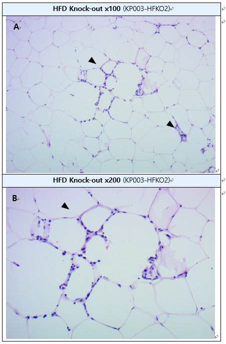 Inflammatory macrophage infiltration in gonadal white adipose tissue (H&E staining) A: Gonadal white adipocytes, B : High-magnification of A