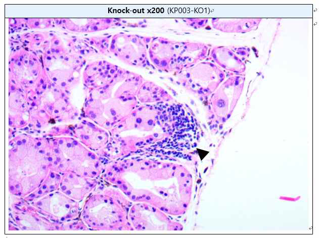 Lymphocytic focal inflammation in Harderian gland (H&E staining) A: Harderian gland, B : High-magnification of A