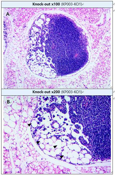 Lipomatosis in cranial mediastinal lymph node (H&E staining) A: : Cranial mediastinal lymph node, B : High-magnification of A