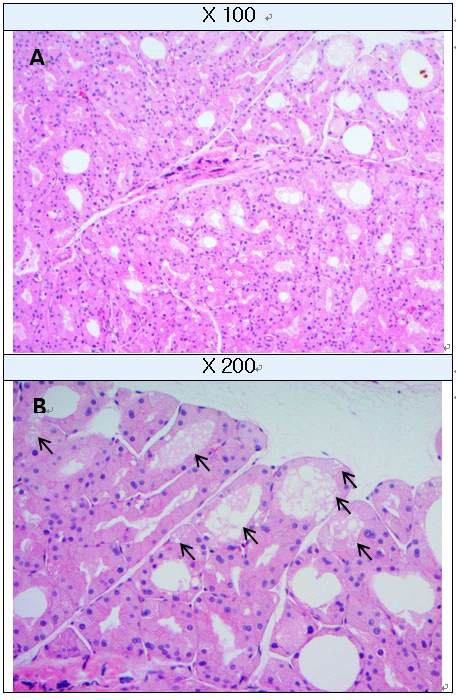 Lipomatosis in Harderian gland (H&E staining) A : Harderian gland, B : High-magnification of A