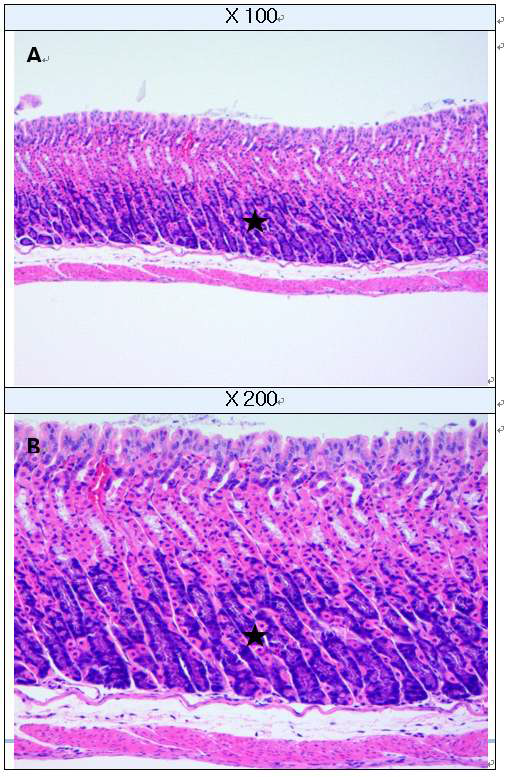 Chief cell hyperplasia in stomach (H&E staining) A : Chief cells in stomach, B : High-magnification of A