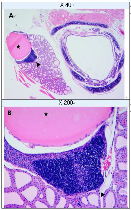 C-cell hyperplasia in thyroid and cystic dilation in parathyroid (H&E staining) A: Thyroid and parathyroid (Next to trachea) , B : High-magnification of A