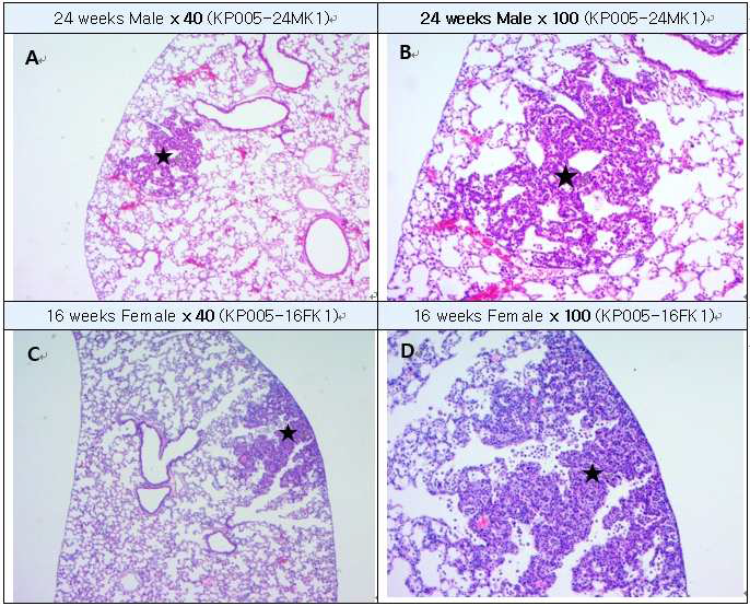 Ahnak KO 마우스의 폐에서 발견된 hyperplasia A : 24 weeks old male lung, B : High-magnification of A, C: 16 weeks old female lung, D : High-magnification of C