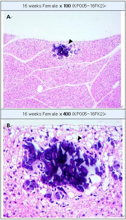 Focal calcification in interscapular brown adipose tissue (H&E staining) A: Calcification in iBAT, B : High-magnification of A