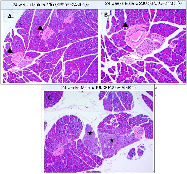 Focal necrosis in pancreas and hyperplasia of pancreatic duct(H&E staining) A: Hypertrophic pancreatic duct (arrow head), B : High-magnification of A, C : Focal necrosis of pancreas(Star)