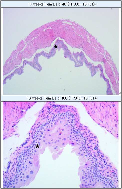 Focal calcification in interscapular brown adipose tissue (H&E staining) A: Wall of urinary bladder, B : High-magnification of A