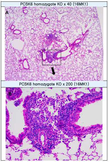 PCSK6 homozygous KO의 lymphocytic inflammation