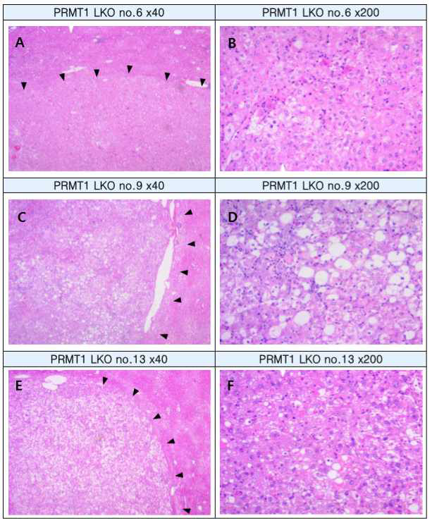 PRMT1 liver-specific KO (LKO) +HFD group