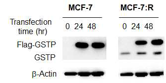 Flag-GSTP의 과발현을 보여주는 western blot. MCF-7:R은 MCF-7에서는 발현되지 않았던 GSTP단백질의 과발현 (gene 수준에서도 과발현)이 관찰되었음. 효율적인 Pull-down assay를 위해 GSTP-Flag plasmid를 클론한 후, 플라스미드를 transfection한 후 GSTP-Flag의 발현 정도를 확인하였음. 단백질 과발현은 48 hr까지 지속됨을 확인함