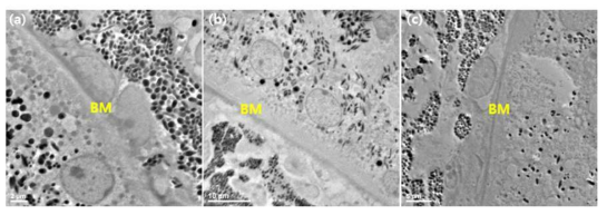 주사현미경을 이용해 관찰한 (a) 3달령, (b) 20달령, (c) 약물 처리한 20달령 쥐 안구의 Brunch’s membrane