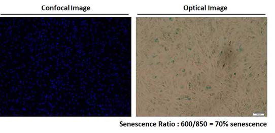 환자에게서 채취한 노화조직의 X gal Assay 후 Confocal Image와 Optical Image를 보여주는 그림