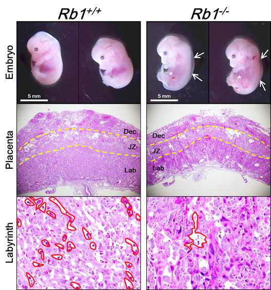 Rb1 결손 E13.5 태아 및 태반의 표현형 확인. Asterisks, paler liver. Arrows, subcutaneous oedema. Red-lined areas, fetal blood space. Dec, decidua. JZ, junctional zone. Lab, labyrinth. (Magnification, x40 in second row, x400 in third row)