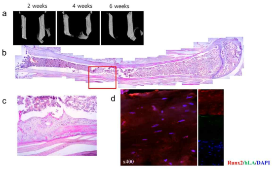 인간 중간엽 줄기세포의 대퇴골 골절 회복에 대한 효과. 대퇴골 골절 모델에서 인간 중간엽 줄기세포의 골형성을 분석하기 위해서, 인간 중간엽 줄기세포(Lonza, Switzerland)를 MSCGM-CD(Lonza, Switzerland) 배지로 7 계대 배양하여 단일세포로 수집한 후 l mm x l mm로 절단한 콜라겐 멤브레인(SK bioland, Korea)에 세포를 흡수시킴. 6주령의 Balb/c- 누드마우스에서 한쪽의 경골을 1 mm 정도 드릴(Bosch professional, Germany)로 구멍을 낸 후 콜라겐 멤브레인이 함유하고 있는 인간 중간엽 줄기세포를 마우스의 골절부위에 삽입함. 매 2 주마다 마우스를 마취한 후 골절부위에 대해 Micro-CT(Skyscan 1076, Antwerp, Belgium)를 사용해서 이미지를 얻음 (a). 6주 후에 H&E 염색 (b, c)과 골 마커인 Runx2에 대한 항체 anti-Runx2, 인간 중간엽 줄기세포 유래임을 보이기 위한 anti-huamn leukocyte antigen (hLA)로 이중 염색을 실시함 (d). DAPI는 핵을 대조염색한 것임