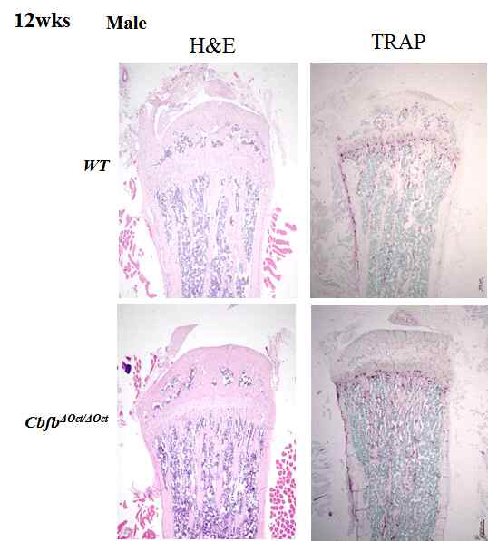 CbfbΔOct/ΔOct 에서의 조직학적 뼈 형태 표현형 분석 H&E염색을 통하여 뼈의 형태를 관찰함, TRAP 염색을 통하여 파골세포 수를 관