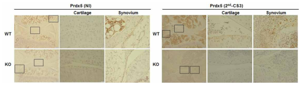 IHC를 통한 Prdx5 KO와 WT CIA 마우스의 Prdx5발현 확인