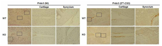 IHC를 통한 Prdx5 KO와 WT CIA 마우스의 Prdx3발현 확인