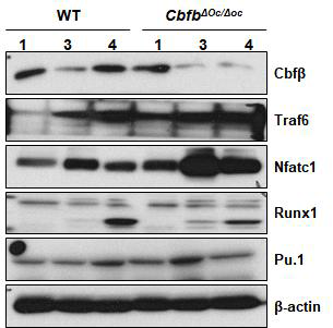 cbfb 결실에 의한 파골세포 분화 표지자들의 단백질 발현 변화