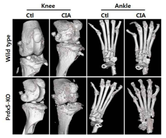 Prdx5 결손 마우스의 골 관절염 유발 모델의 micro-CT 분석