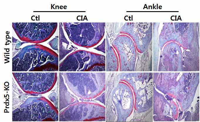 Prdx5 결손 마우스의 골 관절염 유발 모델의 조직염색 분석