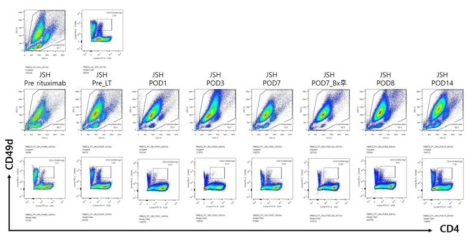 간이식 환자의 혈액에서 CD49d high CD4T 세포 분석