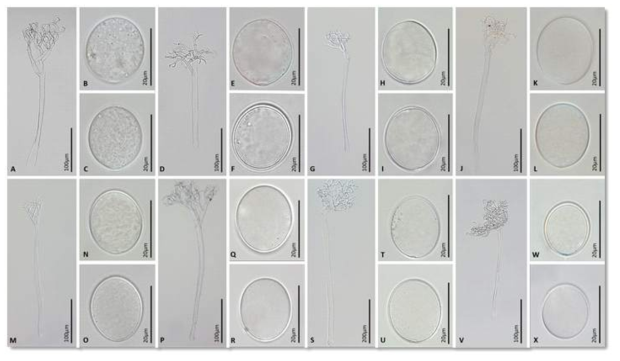 Hyaloperonospora brassica complex ex Brassica campestris (A-C), Brassica napus (D-F), Brassica nigra (G-I), Brassica oleracea (J-L), Raphanus raphanistrum (M-O) and Raphanus sativus (P-R), Sinapis alba (S-U) and Sinapis arvensis (V-X). Conidiophore (A, D, G, J, M, P, S, V), and conidia (B-C, E-F, H-I, K-L, N-O, Q-R, T-U, W-X )