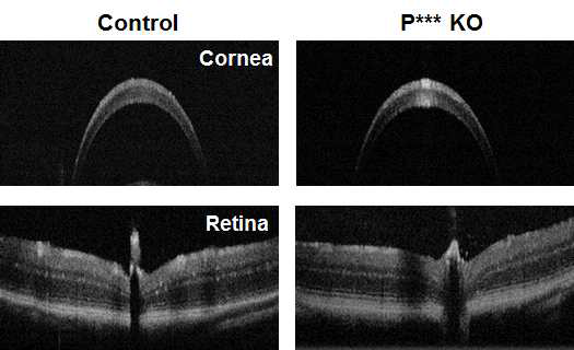 P*** KO의 OCT 분석: cornea (위),retina (아래)