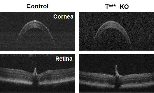 T*** KO의 OCT 분석: cornea (위), retina(아래)