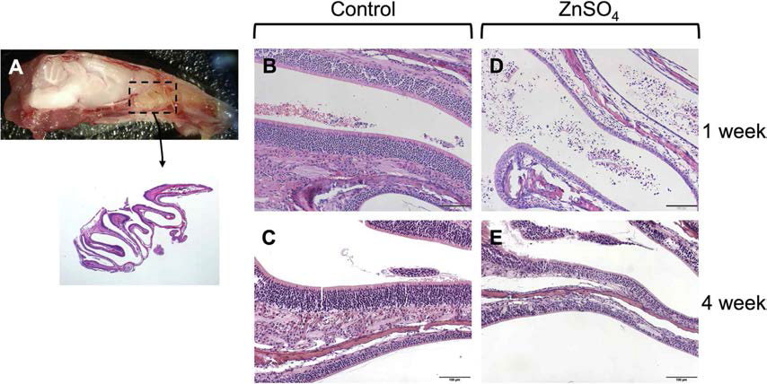Histology of olfactory epithelium in control and ZnSO4 mice (H&E staining, x100)