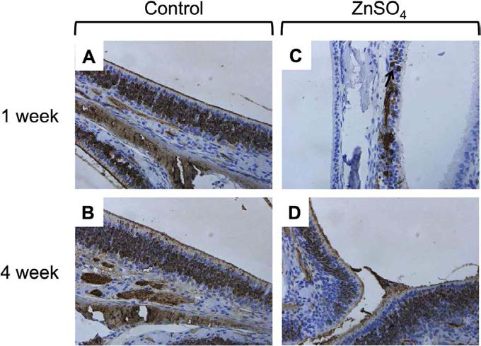 Immunohistochemistry with anti-OMP antibody in control and ZnSO4 mice