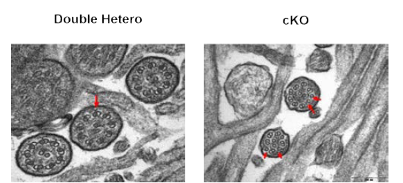 Olfactory cilia inner structure observed by TEM of K*** cKO with 23wks
