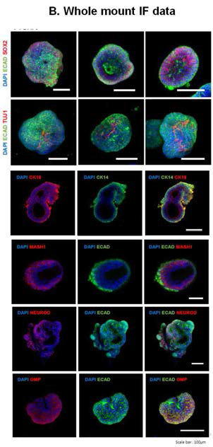 OE-derived organoid microscope data