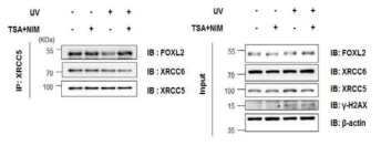 DNA 손상이 유도 조건에서 FOXL2, XRCC5, XRCC6 단백질의 Serine 잔기 인산화 및 Lysine 잔기 아세틸화 확인