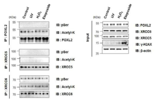 DNA 손상이 유도 조건에서 FOXL2, XRCC5, XRCC6 단백질의 Serine 인산화 및 Lysine 아세틸화 확인