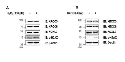 H2O2 (A) 및 UV (B) 처리에 의한 FOXL2 단백질 변화