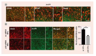 p-p38 expression in p38 siRNA encapsulated pLGA NP