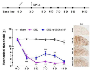 The degree of pain confirmed by mechanical threshold and microglia activation after spinal nerve ligation (SNL)