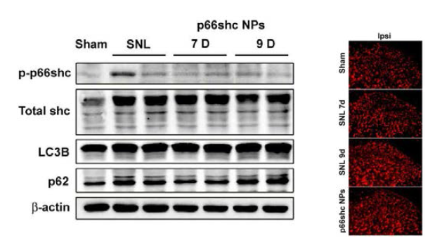 Protein level of the autophagy related factors and p66shc were identified in SNL model. & Formation of mitochondrial ROX after p66chc NP indection in SNL model