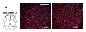 DHE staining in spinal dorsal horn of SNL