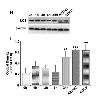 LC3 expression in neuronal cell with microglia CM treatment