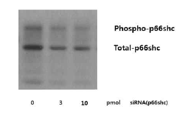 p66shc siRNA treatment