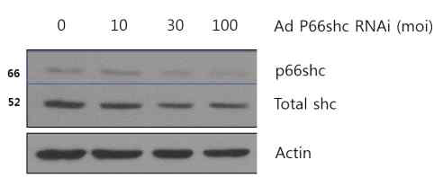adenop66shcRNAi vector