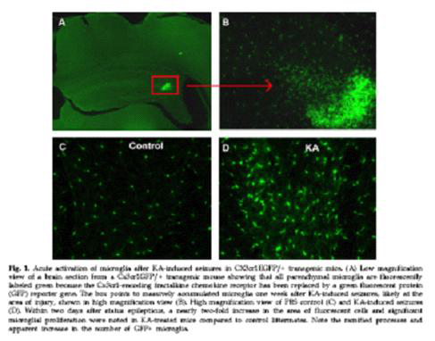 카이닉산 투여로 유발된 간질 중첩중 쥐에서 증가된 microglia