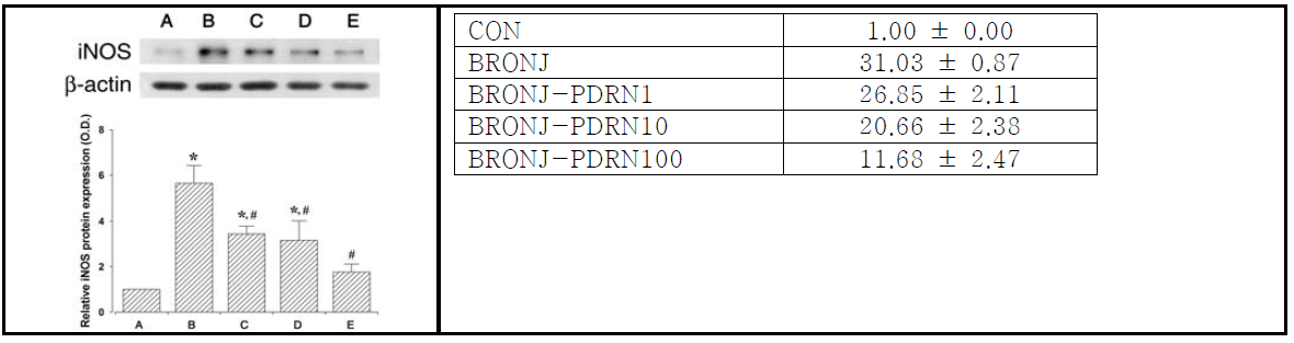 PDRN 투여가 western blot를 통한 iNOS 생성량 변화에 미치는 영향. (A) 대조군, (B) BRONJ 유발군, (C) BRONJ 유발 후 1μg/ml PDRN처리군, (D) BRONJ 유발 후 10μg/ml PDRN처리군, (E) BRONJ 유발 후 100μg/ml PDRN처리군, (F) BRONJ 유발 후 1000μg/ml PDRN처리군. *represents P < 0.05 compared to the control group, #represents P < 0.05 compared to the BRONJ-induced group