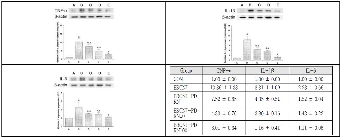 PDRN 투여가 western blot를 통한 염증성 사이토카인 (TNF-α, IL-1β, IL-6) 변화에 미치는 영향. (A) 대조군, (B) BRONJ 유발군, (C) BRONJ 유발 후 1μg/ml PDRN처리군, (D) BRONJ 유발 후 10μg/ml PDRN처리군, (E) BRONJ 유발 후 100μg/ml PDRN처리군, (F) BRONJ 유발 후 1000μg/ml PDRN처리군. *represents P < 0.05 compared to the control group, #represents P < 0.05 compared to the BRONJ-induced group