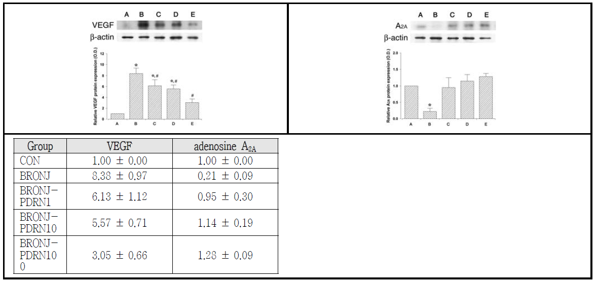 PDRN 투여가 western blot을 통해 확인한 angiogenesis 인자인 VEGF와 adenosine A2A 수용체 변화에 미치는 영향 (A) 대조군, (B) BRONJ 유발군, (C) BRONJ 유발 후 1μg/ml PDRN처리군, (D) BRONJ 유발 후 10μg/ml PDRN처리군, (E) BRONJ 유발 후 100μg/ml PDRN처리군, (F) BRONJ 유발 후 1000μg/ml PDRN처리군. *represents P < 0.05 compared to the control group, #represents P < 0.05 compared to the BRONJ-induced group