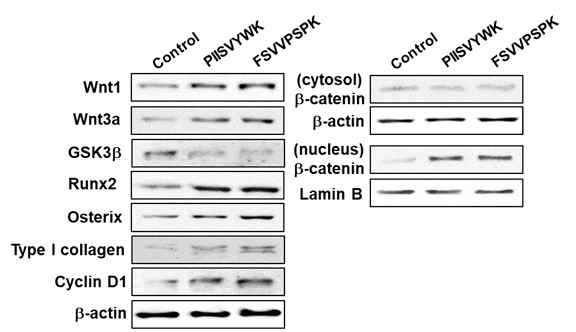 조골세포분화에서 Wnt/β-catenin 신호 활성화에 미치는 영향
