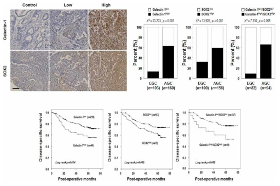 위암조직에서의 갈렉틴-1과 SOX2 레벨에 따른 위암환자군 예후 분석