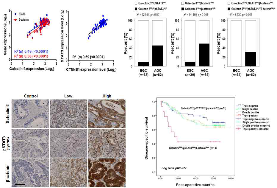 갈렉틴-3, ß-catenin (CTNNB1), STAT3 발현 정도에 따른 위암환자군 예후 분석