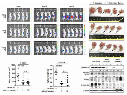 갈렉틴-3 저해제의 in vivo 항종양효과